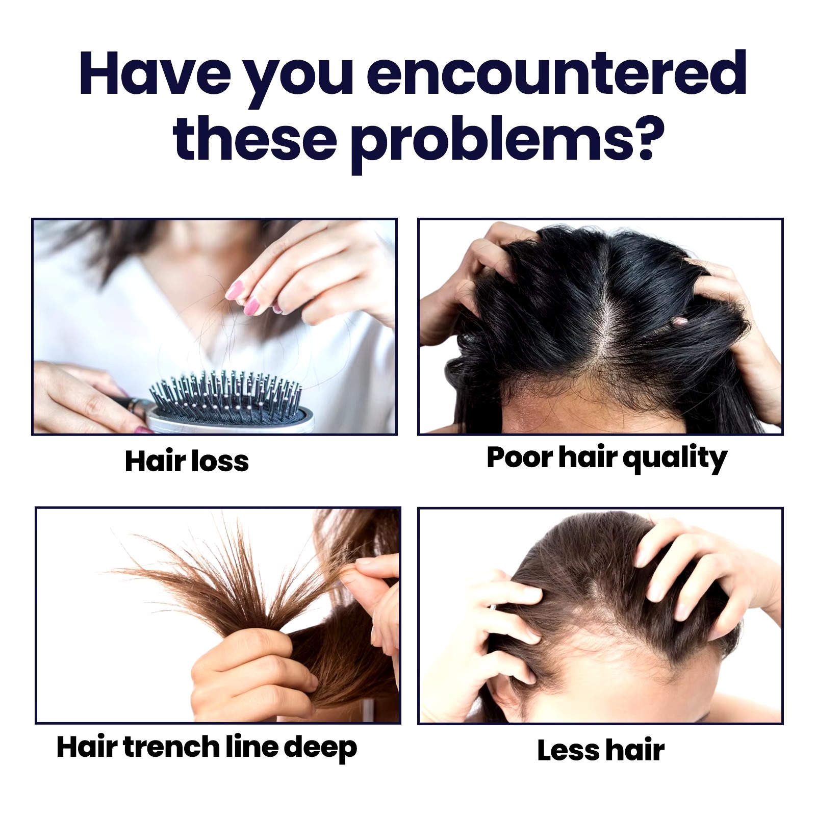 Hair Growth Spray-100ml - Image 2