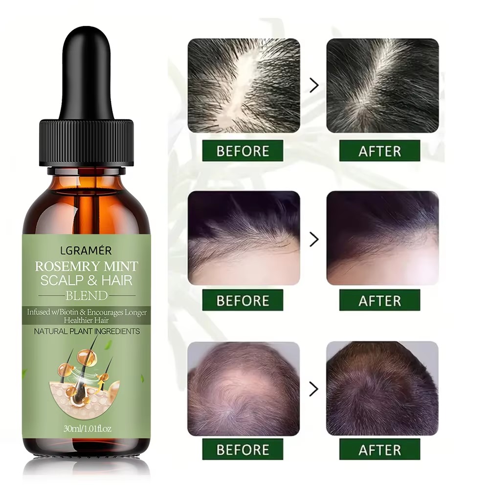 Hair Growth Essential Oil Rosemary Mint - 50ml - Image 5